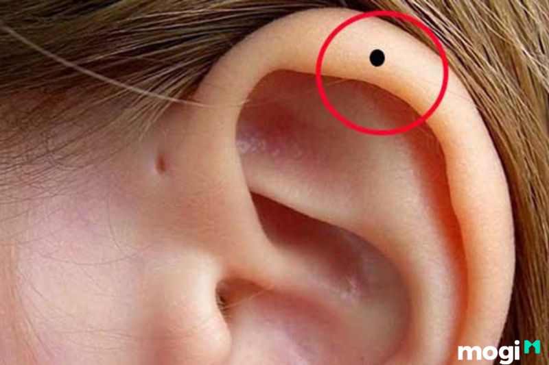  Nốt ruồi nằm ở vành tai của nữ
