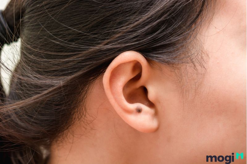 Nốt ruồi nằm ở dái tai của nữ