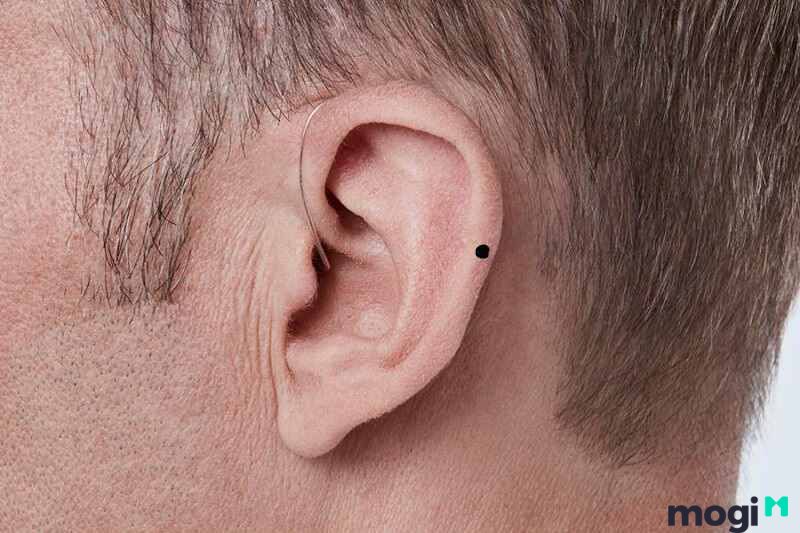 Nốt ruồi nằm ở vành tai nam giới