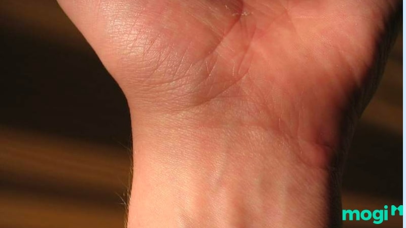 Những dấu vân tay xấu: dấu vân tay tình duyên bị đứt đoạn