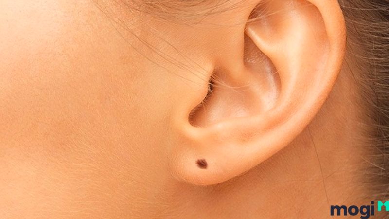 Nốt ruồi phú quý ở vành tai