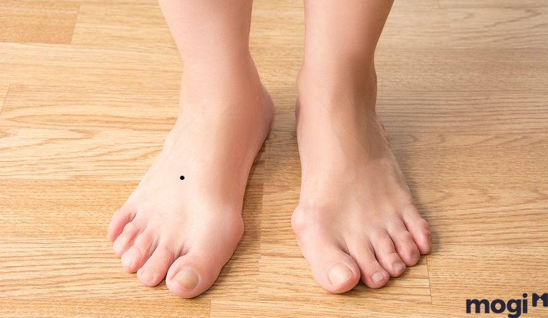 Điềm báo không tốt cho người có nốt ruồi ở mu bàn chân