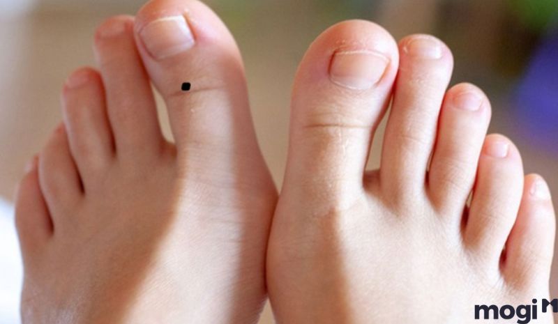 Nốt ruồi ở chân đặt biệt là ở ngón cái mang lại may mắn giúp cho chủ nhân hanh thông trên con đường sự nghiệp