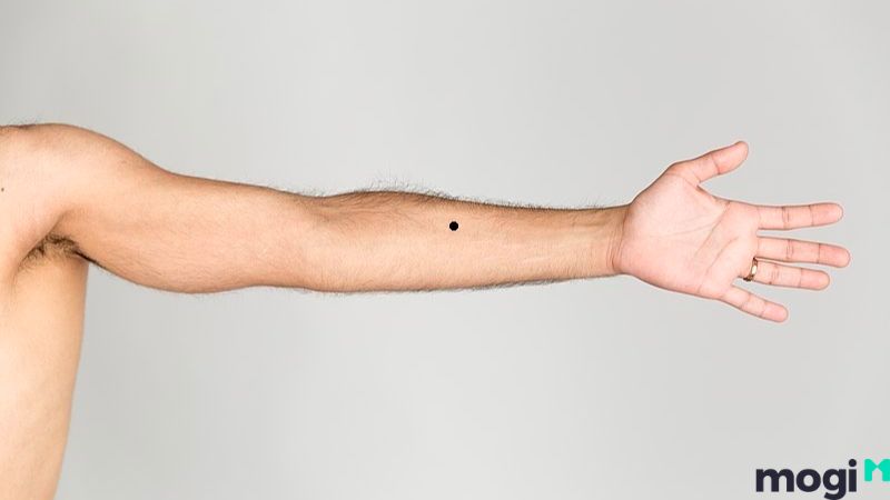 Nốt ruồi ở cánh tay trái nam giới