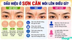 Ý nghĩa tướng số của nếp nhăn, sẹo và nốt ruồi ở sơn căn