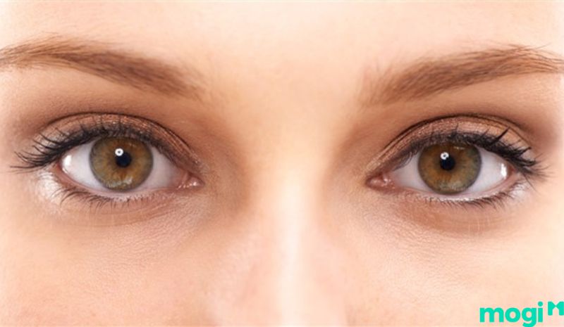 Giải đáp một số câu hỏi liên quan đến mắt âm dương là gì