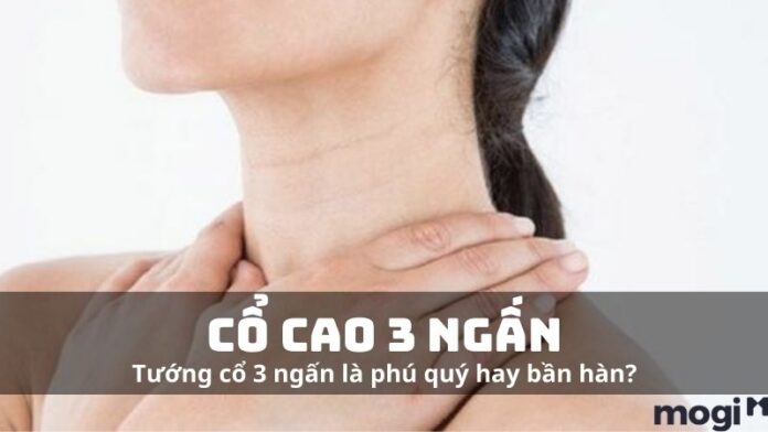 Cổ cao 3 ngấn là tướng phú quý hay bần hèn?