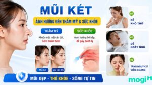 Mũi két là gì? Tốt hay xấu? Xem tướng số nam nữ chi tiết 2 Mũi két ảnh hưởng đến thẩm mỹ và sức khỏe