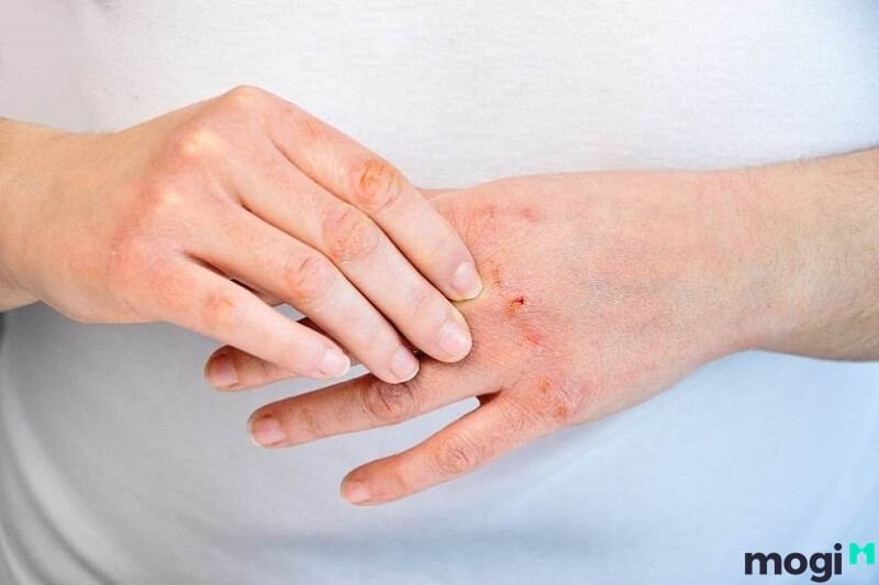 Trong nhiều dòng nước rửa chén có chứa các thành phần hóa học gây hại da tay và sức khỏe khi sử dụng.