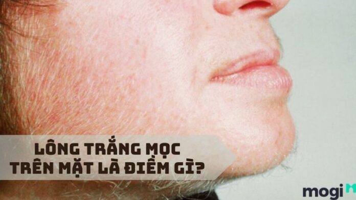 Lông trắng mọc trên mặt