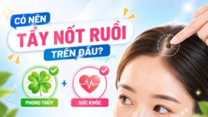 Nốt Ruồi Trên Đầu Có Ý Nghĩa Gì? Giải Mã 5+ Vị Trí Theo Nhân Tướng Học 8 Tẩy nốt ruồi nên cân nhắc kỹ giữa yếu tố thẩm mỹ, phong thủy và sức khỏe