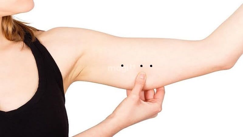 Nốt ruồi trên cánh tay