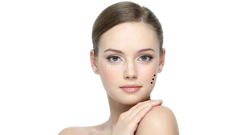 3 nốt ruồi thẳng hàng là tốt hay xấu?