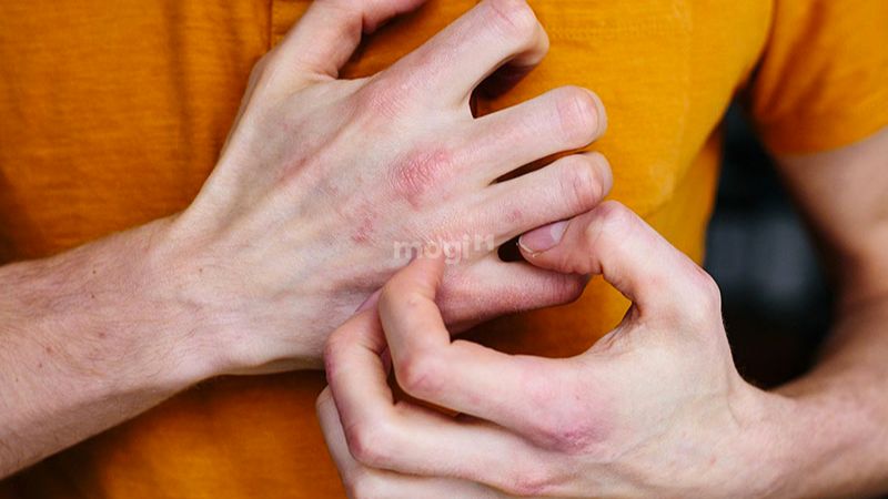 Cách xử lý khi bị ngứa lòng bàn tay phải
