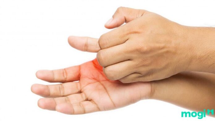 Ngứa lòng bàn tay phải là điềm gì? Cách xử lý hiệu quả